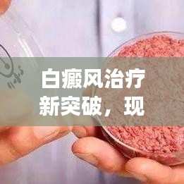 白癜风治疗新突破,现场演唱与最新治疗方法的轻松了解